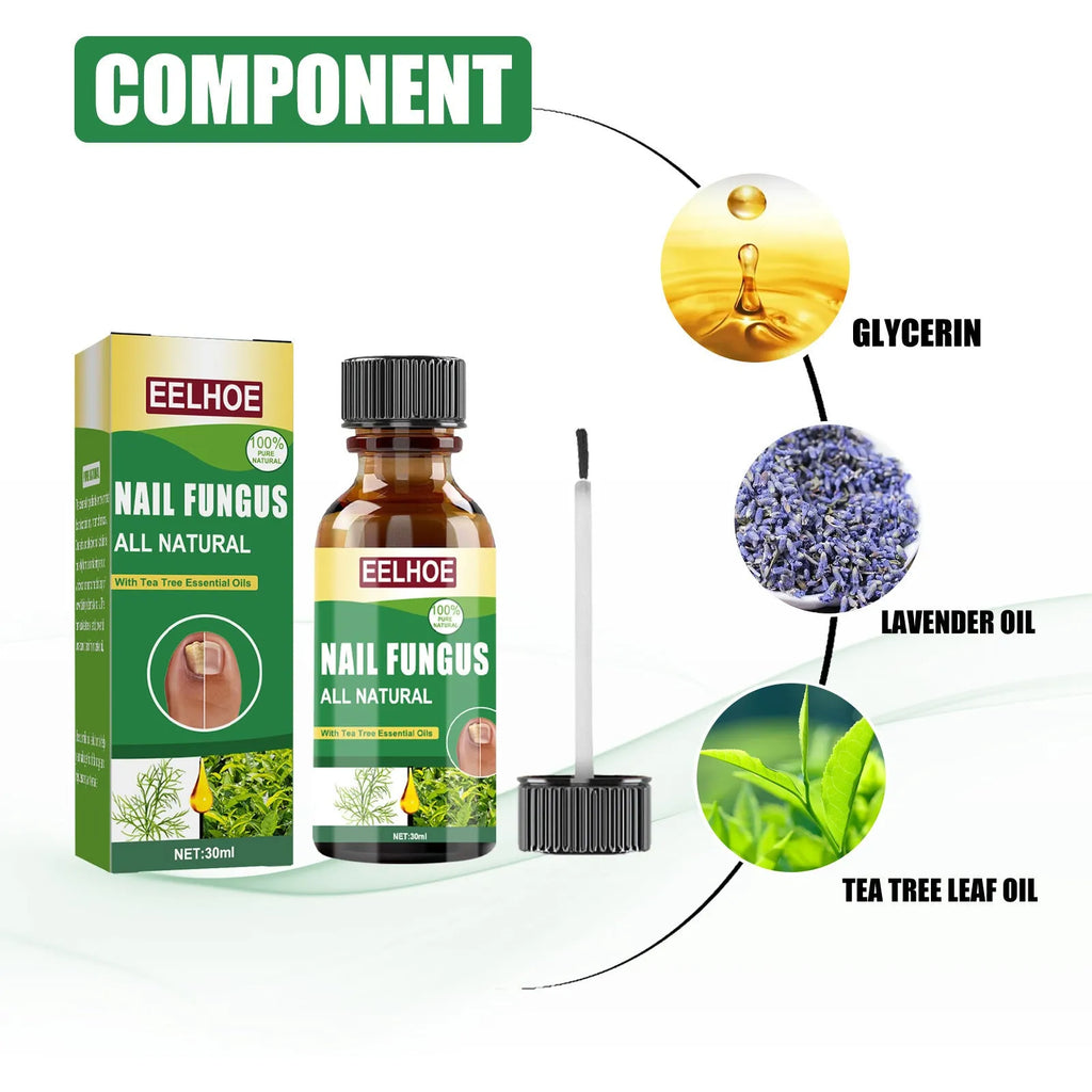 30ml bottle of tea tree oil foot and nail care solution for hand and foot maintenance.