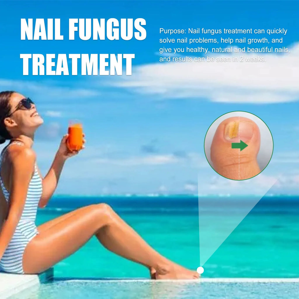 30ml bottle of tea tree oil foot and nail care solution for hand and foot maintenance.