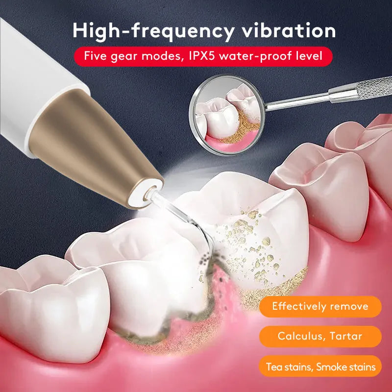 Gold ultrasonic dental tooth cleaner and tartar stain removal device