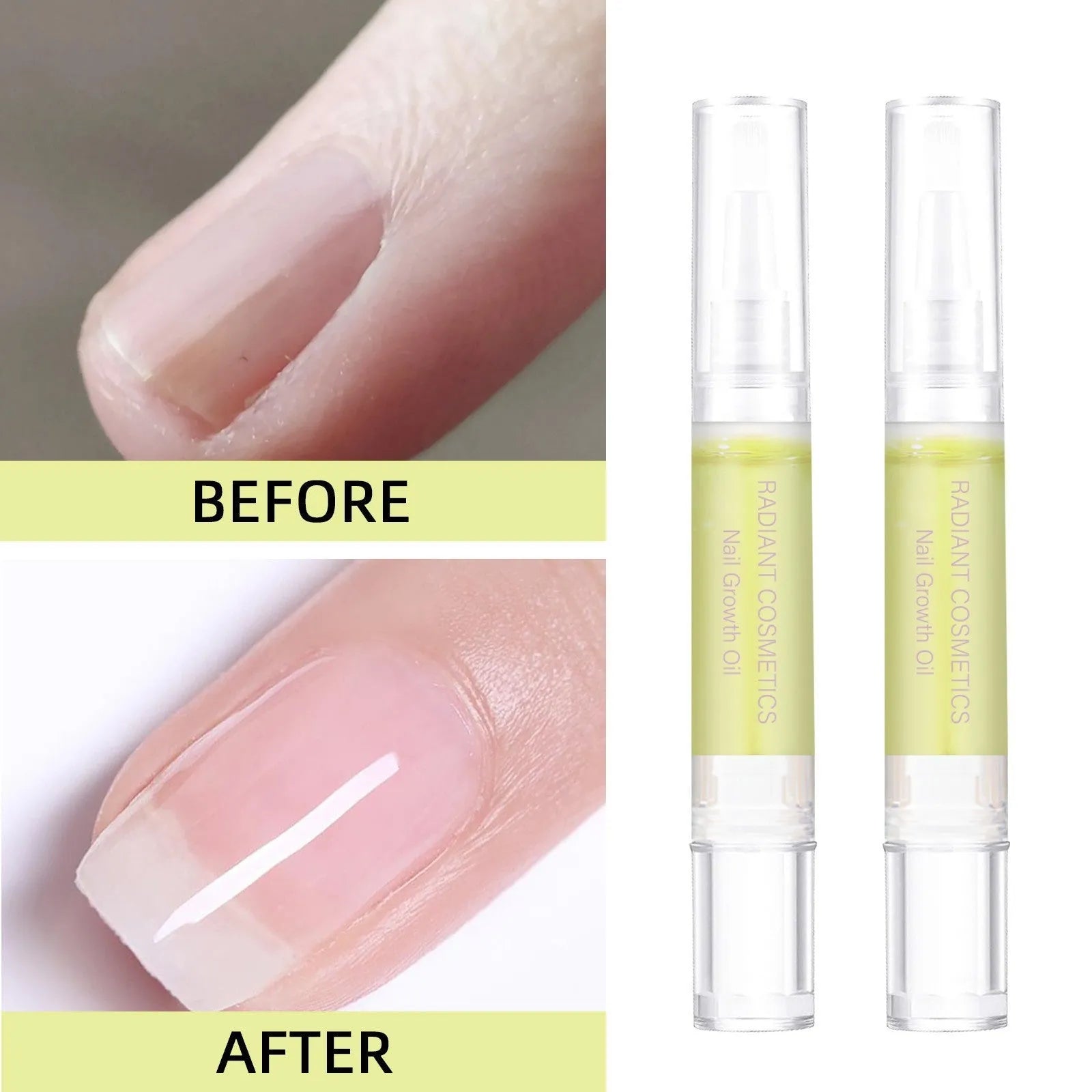 3ml nail growth treatment oil bottle for wash-free cuticle care and moisturising