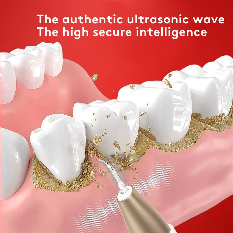 Gold ultrasonic dental tooth cleaner and tartar stain removal device